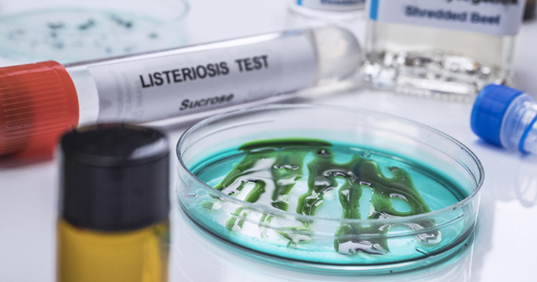 Reglamento (UE) 2024/2895 Listeria